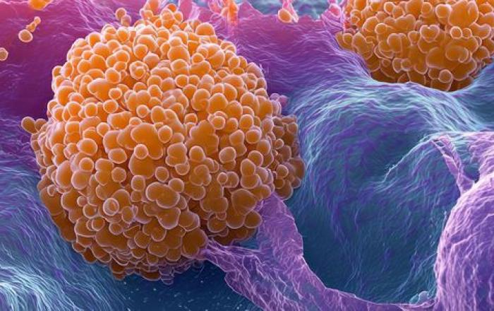 Nuove frontiere terapeutiche per il trattamento del glioblastoma